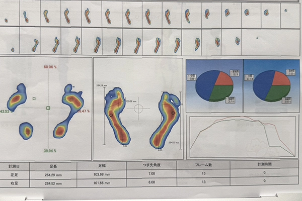 運動パフォーマンスの改善、向上に繋がる治療が出来る